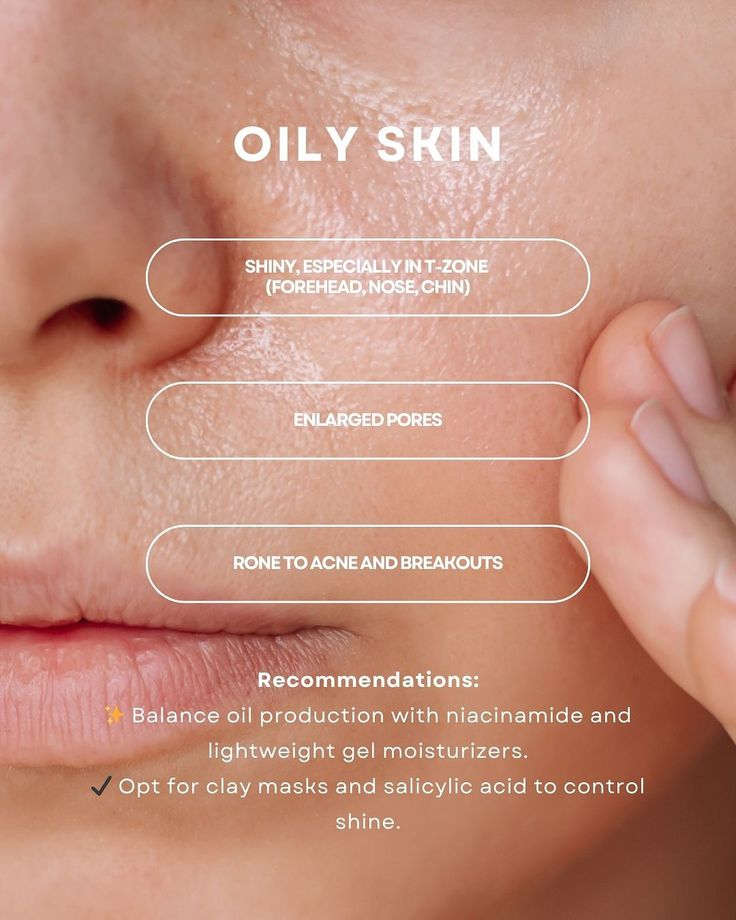 oily skin tone